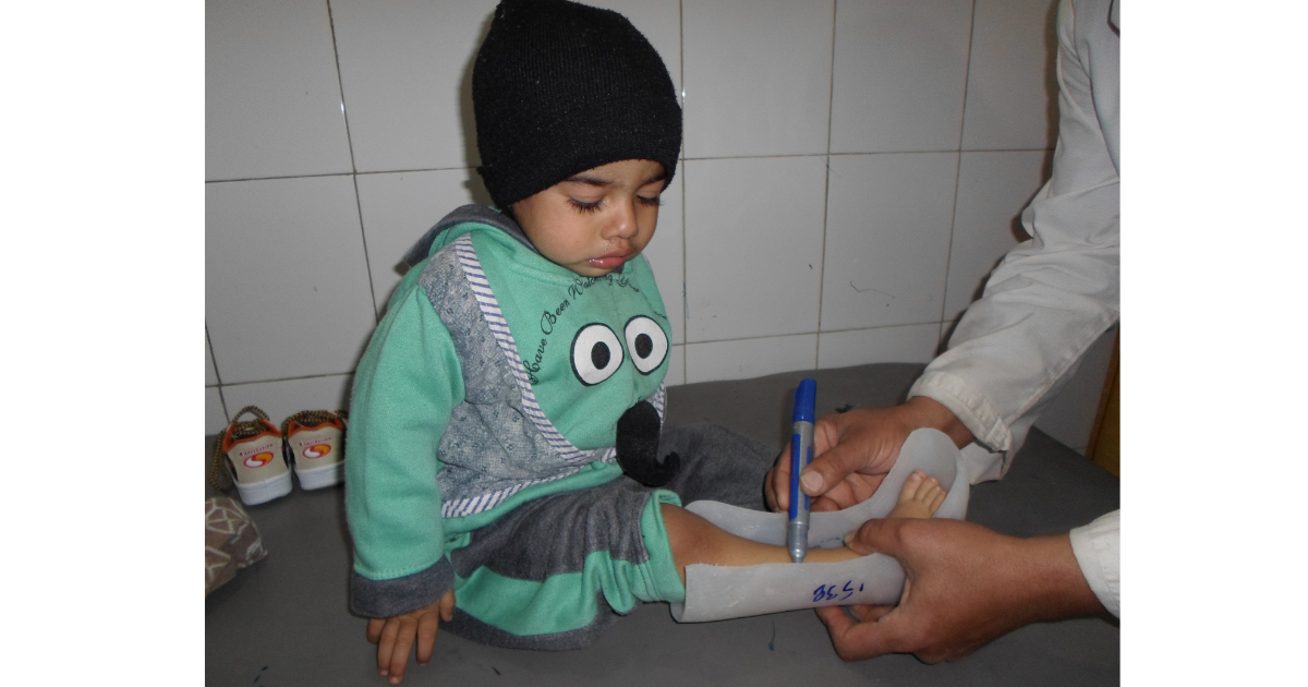 Young boy receiving free orthopedic care